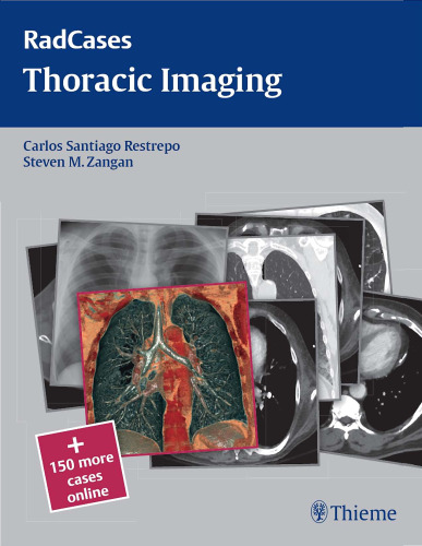 Radcases Thoracic Imaging (Radcases Plus Q&A)