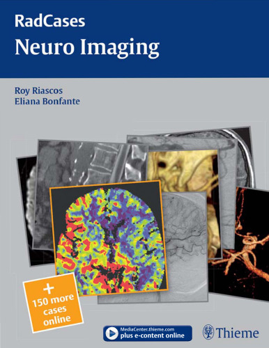 Neuro imaging