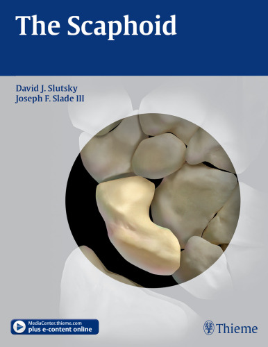 The scaphoid