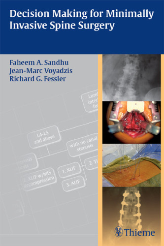 Decision Making for Minimally Invasive Spine Surgery