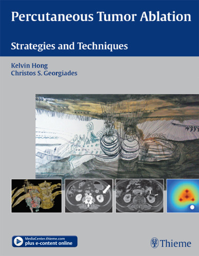 Percutaneous tumor ablation: strategies and techniques