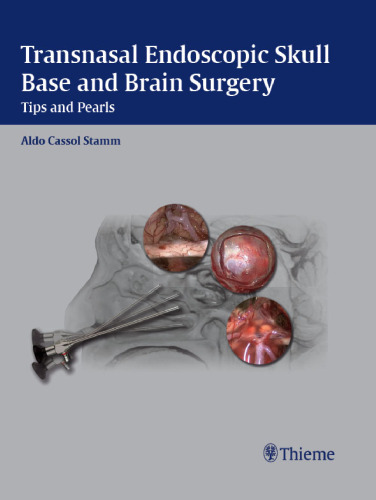 Transasal endoscopic skull base and brain surgery: tips and pearls