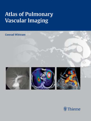 Atlas of pulmonary vascular imaging