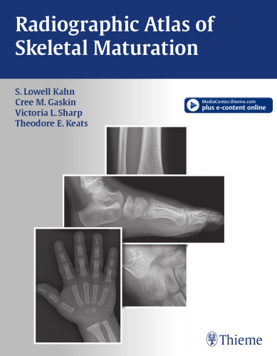 Radiographic Atlas of Skeletal Maturation