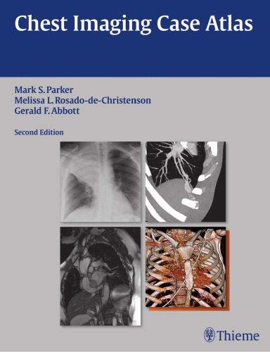 Chest Imaging Case Atlas