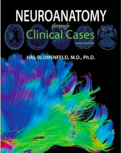 Neuroanatomy through Clinical Case