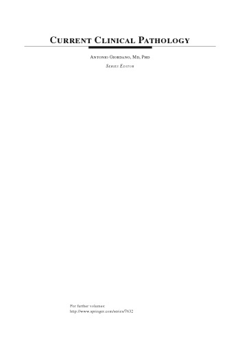 Diagnostic and Prognostic Biomarkers and Therapeutic Targets in Melanoma