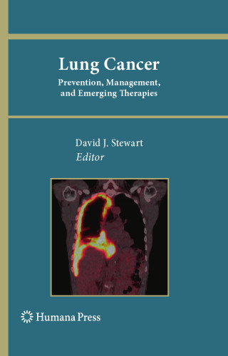 Lung Cancer: Prevention, Management, and Emerging Therapies
