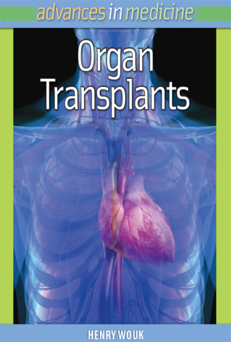 Organ Transplants