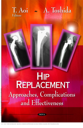 Hip Replacement : Approaches, Complications and Effectiveness