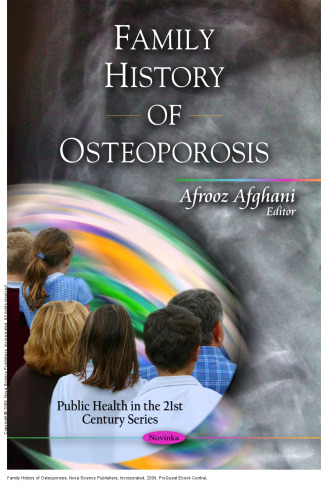 Family History of Osteoporosis