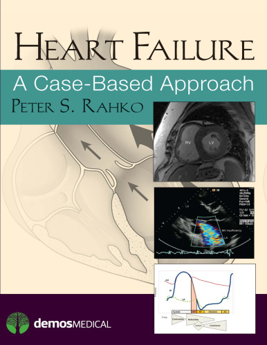 Heart Failure: A Case-Based Approach