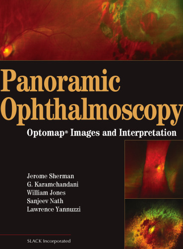 Panoramic Ophthalmoscopy : Optomap® Images and Interpretation