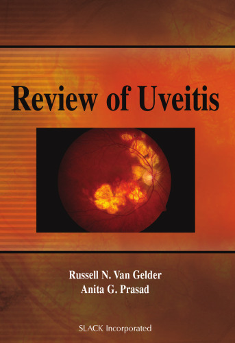 Review of Uveitis