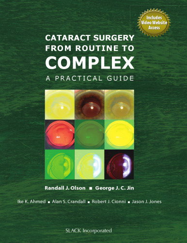Cataract Surgery from Routine to Complex : A Practical Guide