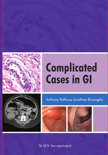Complicated Cases in GI