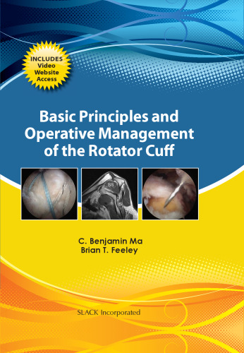Basic Principles and Operative Management of the Rotator Cuff