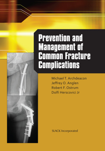 Prevention and Management of Common Fracture Complications
