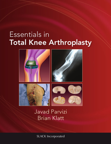 Essentials in Total Knee Arthroplasty