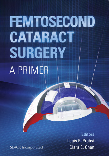 Femtosecond Cataract Surgery: A Primer