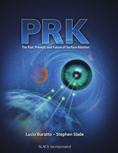 Prk : The Past, Present, and Future of Surface Ablation