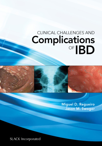 Clinical Challenges and Complications of IBD
