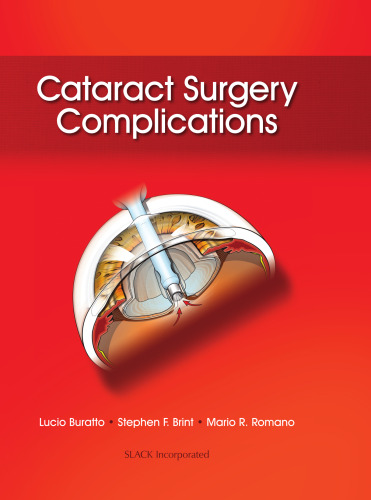 Cataract Surgery Complications