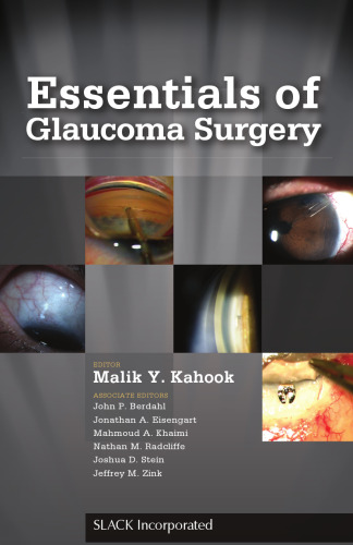Essentials of Glaucoma Surgery