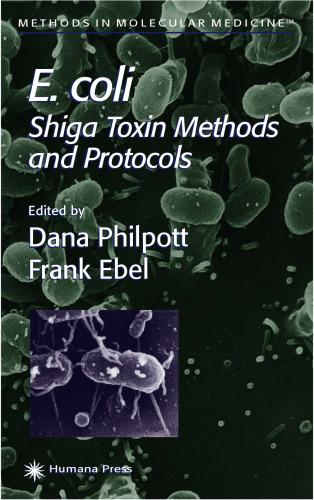 E. coli. Shiga Toxin Methods and Protocols