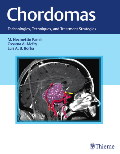 Chordomas: Technologies, Techniques, and Treatment Strategies