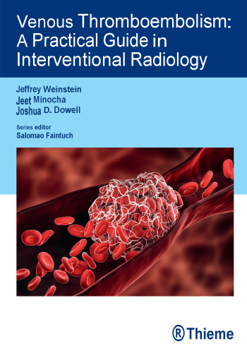Venous Thromboembolism: A Practical Guide in Interventional Radiology