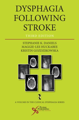 Dysphagia Following Stroke