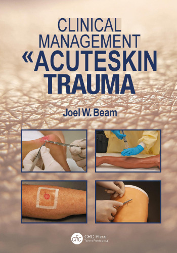 Clinical Management of Acute Skin Trauma