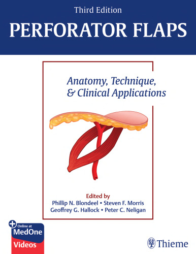 Perforator Flaps Anatomy, Technique, & Clinical Applications
