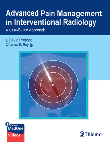 Advanced Pain Management in Interventional Radiology - A Case-Based Approach (Dec 29, 2023)_(1684201403)_(Thieme)