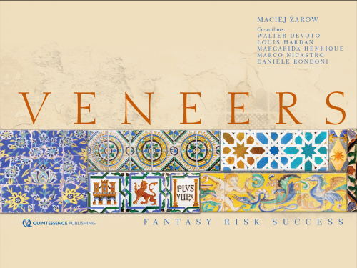 Veneers: Fantasy, Risk, Success