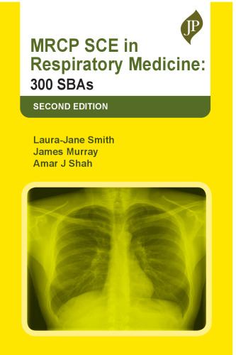 MRCP SCE in Respiratory Medicine: 300 SBAs