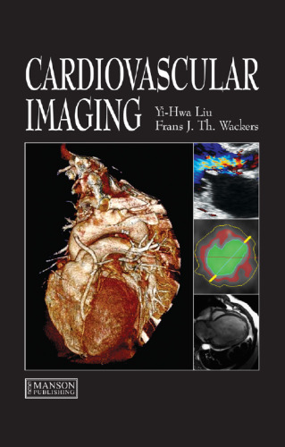 Cardiovascular Imaging