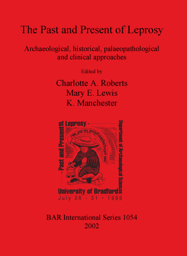 The Past and Present of Leprosy: Archaeological, historical, palaeopathological and clinical approaches