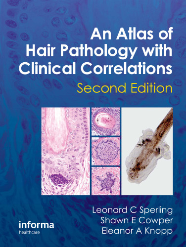 An atlas of hair pathology with clinical correlations