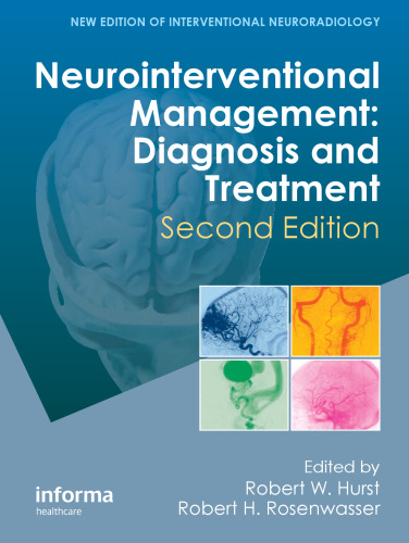 Neurointerventional management: diagnosis and treatment