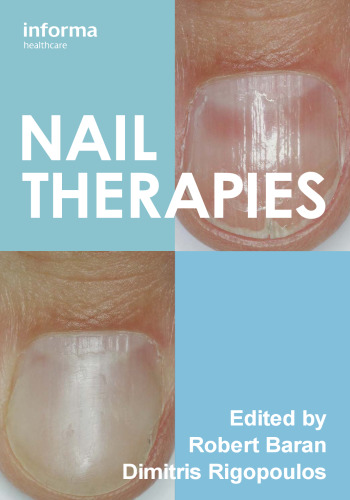 Nail therapies