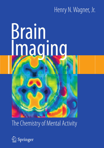 Brain Imaging: The Chemistry of Mental Activity