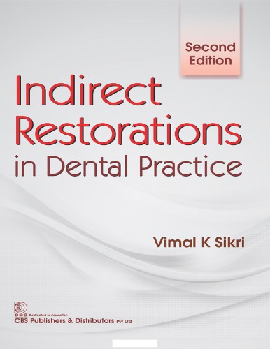 Indirect Restorations