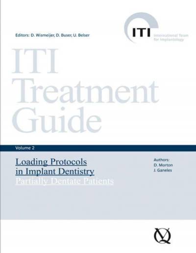 ITI Treatment Guide 2 2