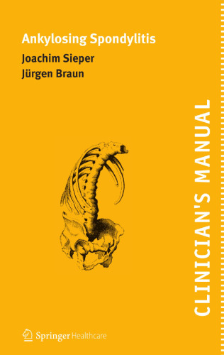 Clinician’s Manual on Ankylosing Spondylitis