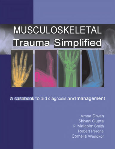 Musculoskeletal Trauma Simplified