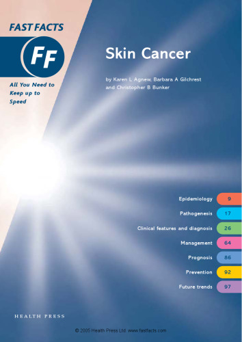 Fast Facts : Skin Cancer