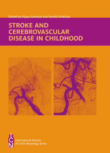 Stroke and Cerebrovascular Disease in Childhood