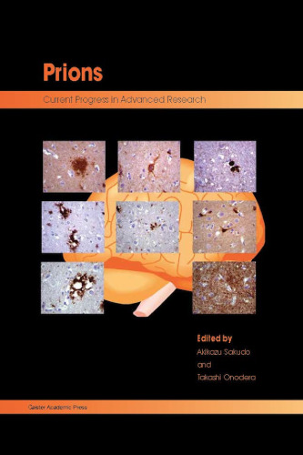Prions : Current Progress in Advanced Research